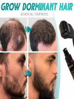Hair & Beard Growth Essence Spray