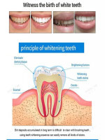 Mintsincerely ™ Teeth Whitening Pens